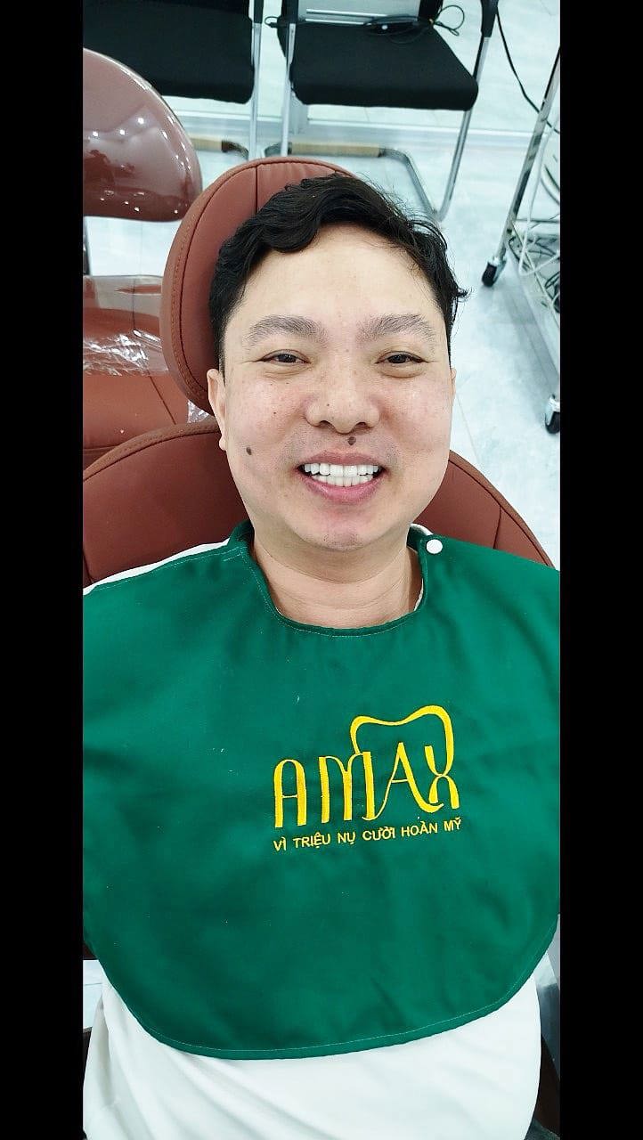 Răng bị ê buốt