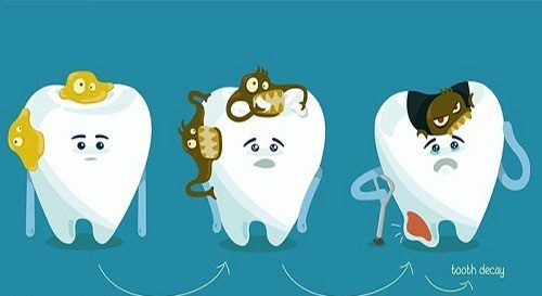Những Thói Quen Xấu Khiến Răng Ngày Càng Hư Hỏng Nặng