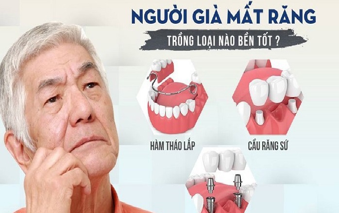 Người Già Nên Đeo Loại Răng Giả Nào Là Tốt Nhất?