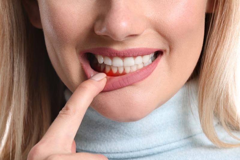 Cách Phòng Ngừa Bệnh Nha Chu