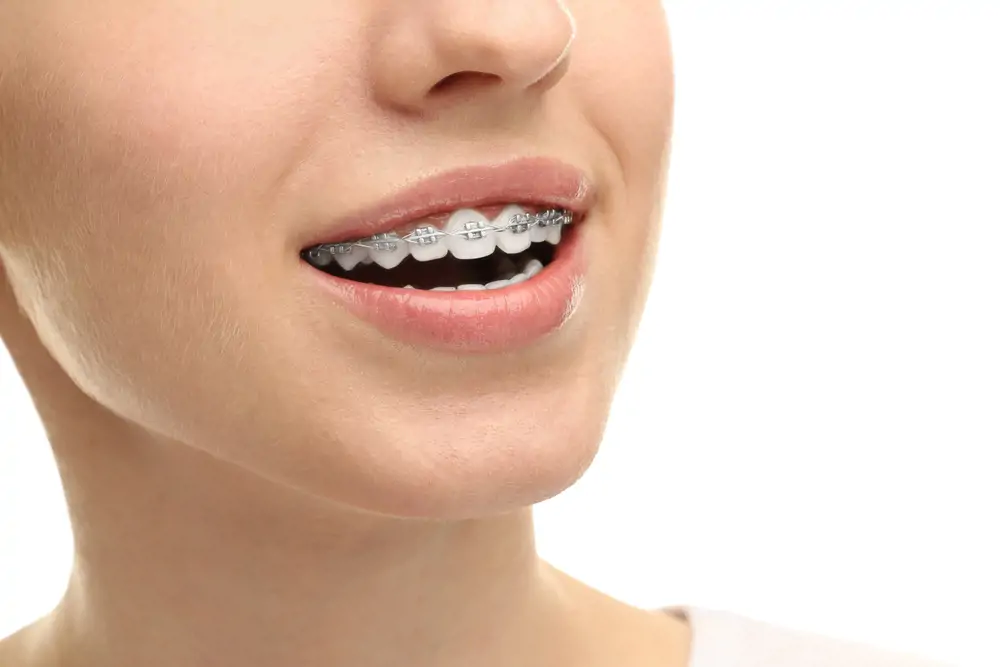 Ăn thịt gà bị nhức răng có phải do bệnh lý viêm nha